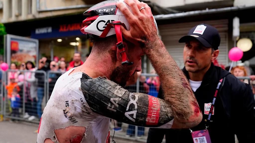 09-05-2026-Bulgarien-Veliko-Tarnovo-Radsport-UCI-WorldTour-Giro-d-Italia-Der-Brite-Adam-Yates-der-in-einen-Sturz-verwickelt-war-blutet-im-Gesicht-am-Arm-und-am-Koerper-nach-der-zweiten-Etappe-des-Giro-d-Italia-von-Burgas-nach-Veliko-Tarnovo