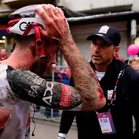 09-05-2026-Bulgarien-Veliko-Tarnovo-Radsport-UCI-WorldTour-Giro-d-Italia-Der-Brite-Adam-Yates-der-in-einen-Sturz-verwickelt-war-blutet-im-Gesicht-am-Arm-und-am-Koerper-nach-der-zweiten-Etappe-des-Giro-d-Italia-von-Burgas-nach-Veliko-Tarnovo